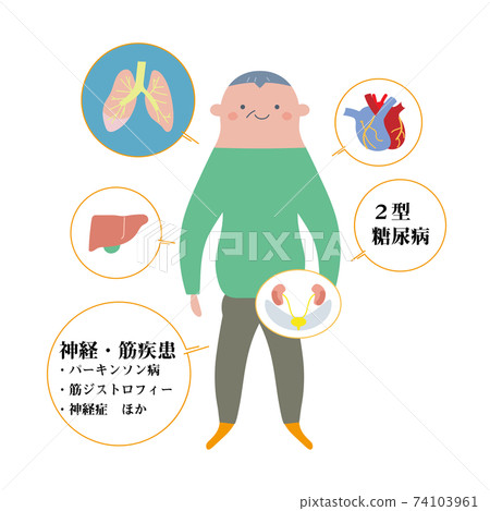 Illustration of an underlying disease modeled on a senior man 74103961