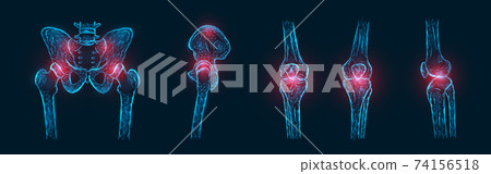 Polygonal vector illustration of pain or inflammation of the bones in the pelvis, hip joint, and knee joints isolated. Joint pain concept 74156518