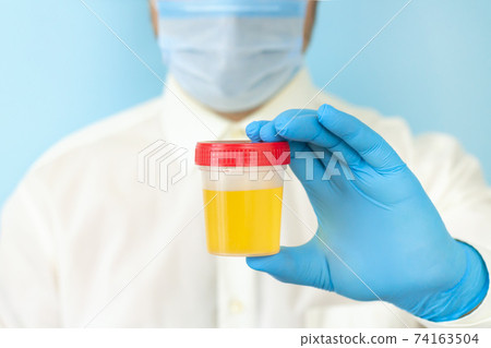 Doctor holding urine sample container for medical urinalysis Doctor holding urine sample container for medical urinalysis 74163504