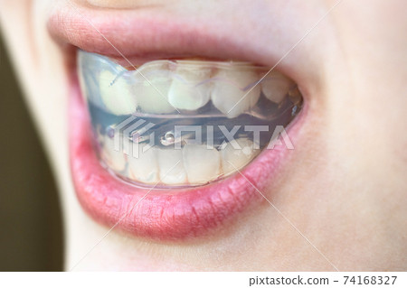 pre-orthodontic trainer for correction of bite 74168327