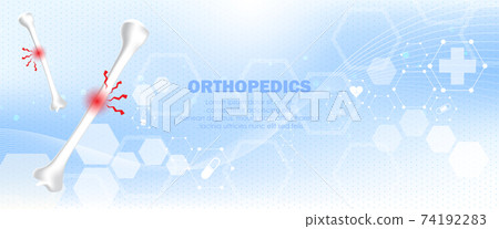 Medical orthopedic abstract background. Treatment for orthopedics traumatology of humerus bones and joints injury. Medical presentation, hospital. Vector illustration	 74192283