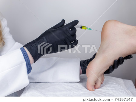 An orthopedic surgeon gives an injection in the heel to relieve pain from a heel spur. The concept of medical care and non-surgical treatments. An orthopedic surgeon gives an injection in the heel to relieve pain from a heel spur. The concept of medical care and non-surgical treatments. 74197147