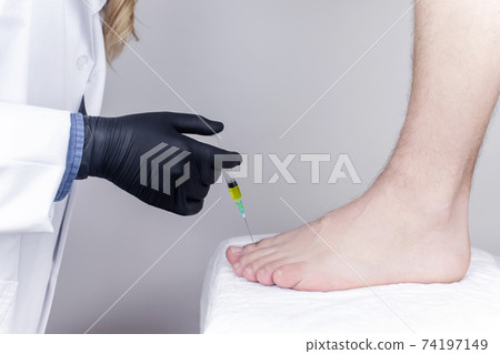 An orthopedic surgeon gives an injection in the finger joint. Treatment of osteoarthritis with hormonal drugs or drugs based on hyaluronic acid. Help with diseases that damage the cartilage of the An orthopedic surgeon gives an injection in the finger joint. Treatment of osteoarthritis with hormonal drugs or drugs based on hyaluronic acid. Help with diseases that damage the cartilage of the 74197149