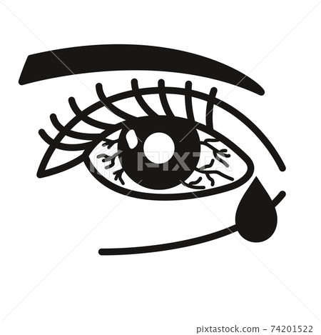 Inflammated eye Conjunctivitis or pink eye 74201522