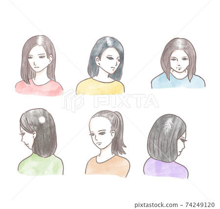 婦女稀疏的頭髮 婦女稀疏的頭髮 74249120