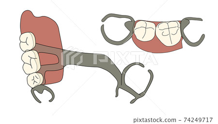 Partial denture Partial denture 74249717