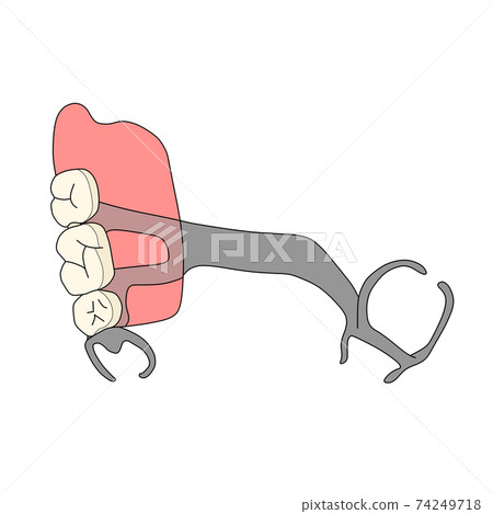 Partial denture 74249718