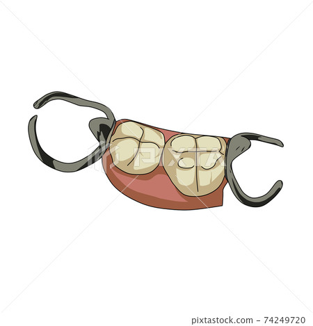 Partial denture 74249720