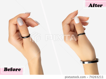 Womans hands before and after manicure correction procedure Womans hands before and after manicure correction procedure 74263211