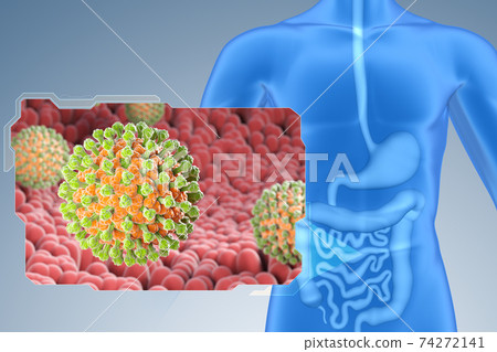 Rotaviruses in small intestine 74272141