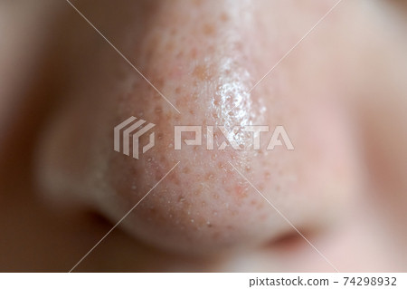 草莓鼻子 74298932