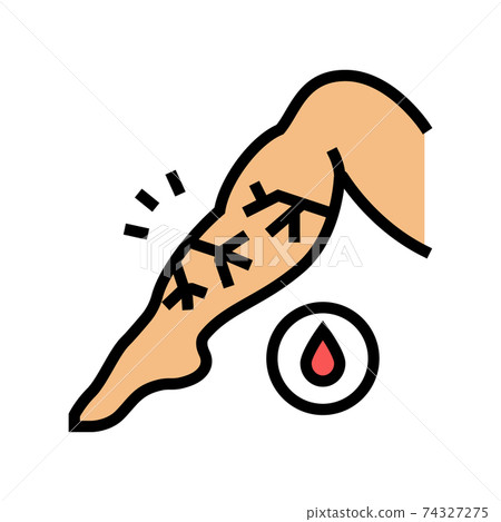 venous edema color icon vector illustration 74327275