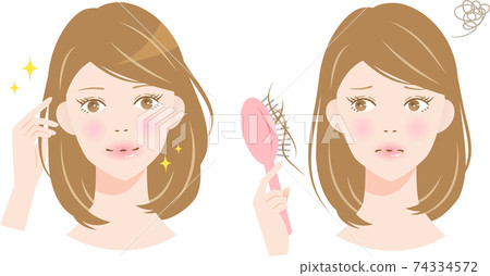 Hair loss female before and after Hair loss female before and after 74334572