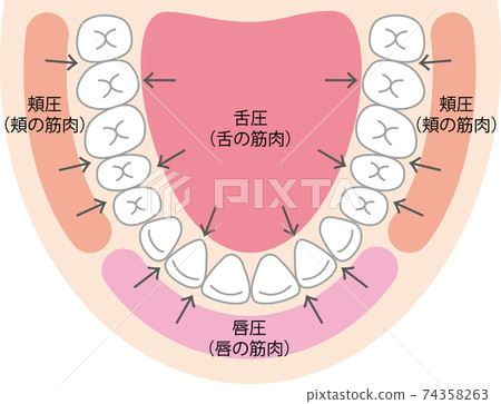 Baccinator mechanism 74358263