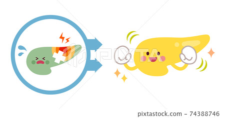 Before and after changing from an unhealthy pancreas to a healthy pancreas 74388746