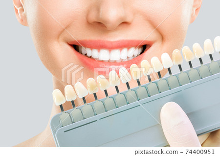 Smiling young woman. Cosmetological teeth whitening in a dental clinic. selection of the tone of the implant tooth 74400951
