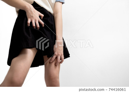 Teen girl scratching crotch caused by herpes,fungal or bacterial infection,tinea cruris in the groin,irritation of skin disease,eczema dermatitis,woman with genital itching,burning,vaginal discharge 74416061