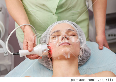 Rf face lift, collagen mask. 74443114