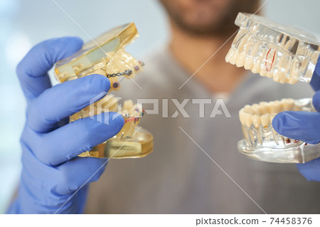 Dentist in gloves demonstrating two teeth replicas 74458376