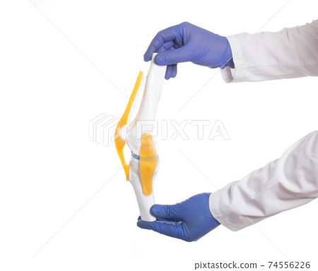 Traumatologist doctor holds a knee joint model on a white background. Knee and Meniscus Injury Concept, treatment 74556226