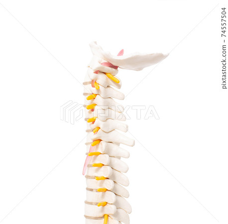 cervical and thoracic spine on a white background, isolate. Osteochondrosis and degenerative changes in the spine, microspondylia cervical and thoracic spine on a white background, isolate. Osteochondrosis and degenerative changes in the spine, microspondylia 74557504