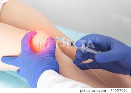 The doctor injects injections with hyaluronic acid into the knee joint of a patient who has pain and arthrosis in the knee. Concept of joint treatment with chondroprotectors, close-up The doctor injects injections with hyaluronic acid into the knee joint of a patient who has pain and arthrosis in the knee. Concept of joint treatment with chondroprotectors, close-up 74557611
