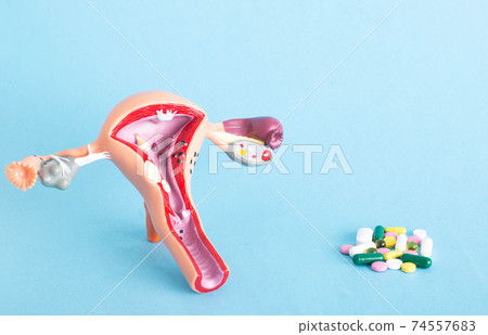 Model of the female genitourinary system on a blue background with pills. Antibiotic treatment concept for gynecological infections. 74557683