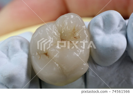 Tooth Tooth 74561566