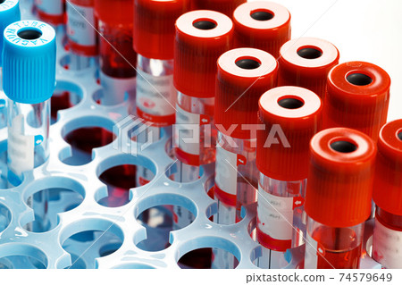 Blood sample tubes medical equipment close up Blood sample tubes medical equipment close up 74579649