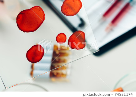 Medical equipment for blood test close up 74581174