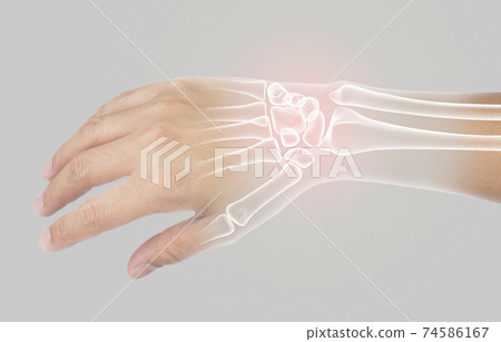 wrist bones injury wrist bones injury 74586167
