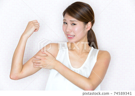 一名婦女過敏和撓她的手臂。 一名婦女過敏和撓她的手臂。 74589341