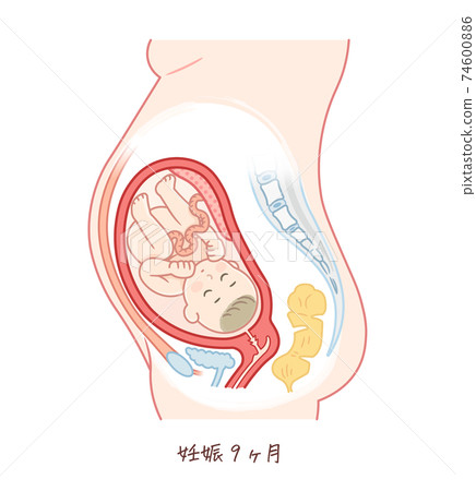 胎兒生長（妊娠9個月） 74600886