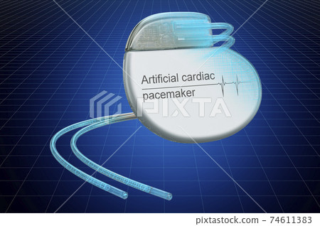 Visualization 3d cad model of artificial cardiac pacemaker, blueprint. 3D rendering Visualization 3d cad model of artificial cardiac pacemaker, blueprint. 3D rendering 74611383
