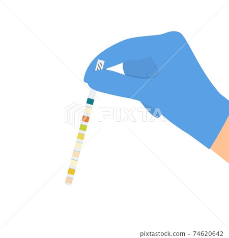 The doctor uses a urine test strip The doctor uses a urine test strip 74620642