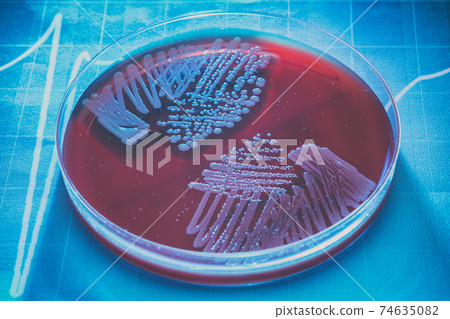 Petri plate with pathological bacteria 74635082