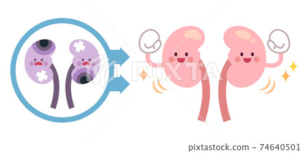從不健康的腎臟變為健康的腎臟之前和之後 從不健康的腎臟變為健康的腎臟之前和之後 74640501