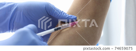 Nurse in rubber gloves makes intravenous injection closeup 74659075