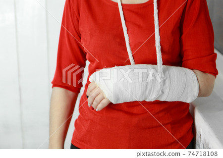 a broken arm. Close-up of the plaster. A lady in a red jacket with a bright manicure. exercises to restore and strengthen the muscles. damage to the bones. 74718108