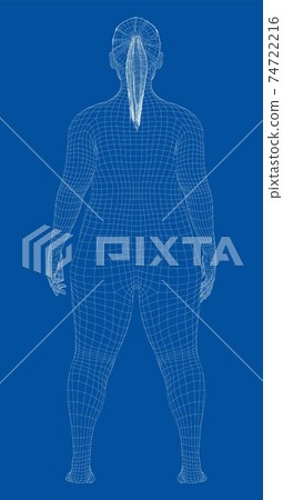 Fat woman, before weight loss 74722216