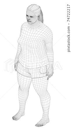 Fat woman, before weight loss Fat woman, before weight loss 74722217