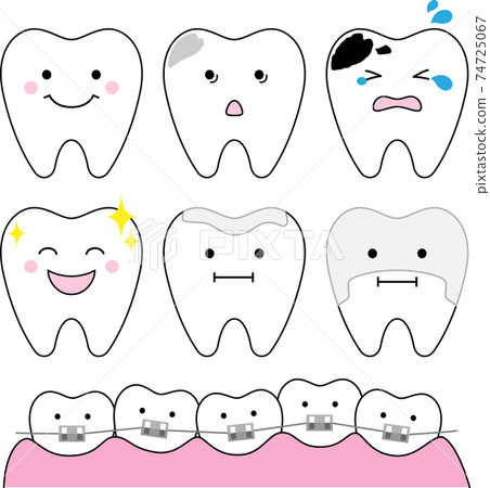 牙齒狀況的圖像說明 74725067