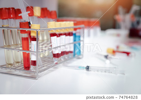 Blood samples in tubes and syringes on work table in a medical examination lab. 74764828