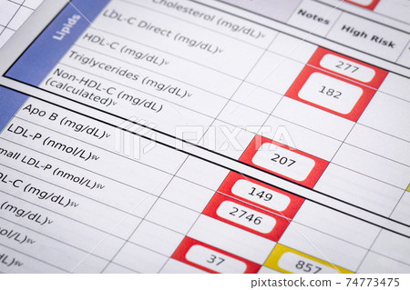 high risk cholesterol test results 74773475