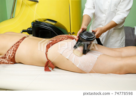 Woman getting cryolipolysis fat treatment on hip in beauty salon Woman getting cryolipolysis fat treatment on hip in beauty salon 74778598