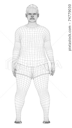 Fat woman, before weight loss 74779030