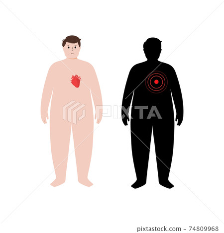 Organs in obese human body 74809968