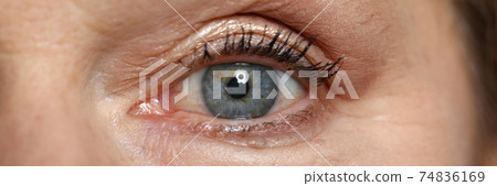 Blue eye of elderly woman look straight. Blue eye of elderly woman look straight. 74836169