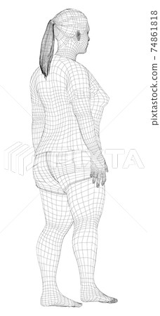 Fat woman, before weight loss 74861818