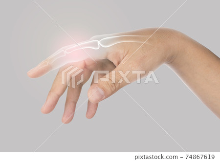 finger bone pain finger bone pain 74867619